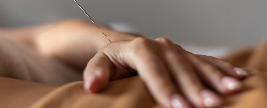 Akupunktur er gavnligt mod en lang række graviditetsgener Lykke Hjerte & Sjæl